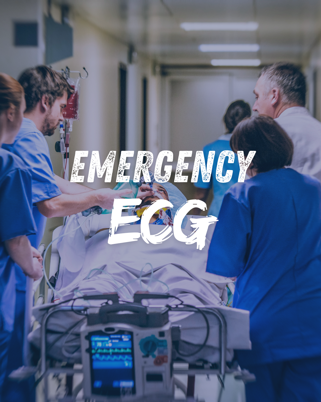 Recognizing STEMI patterns on ECG