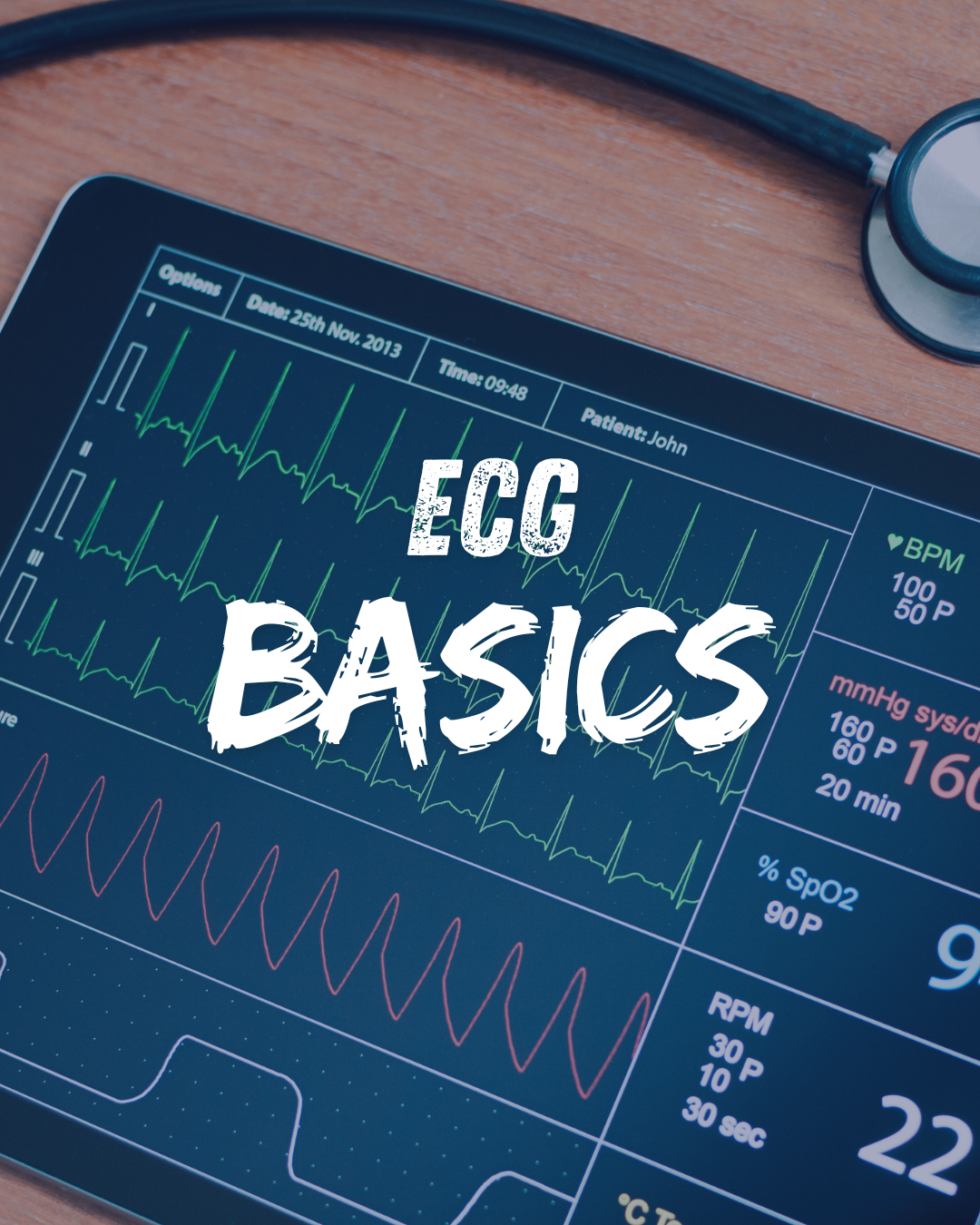 How to read an ECG systematically